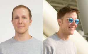 Men's hair replacement systems at Blonde Envy hair salons in Milton Keynes
